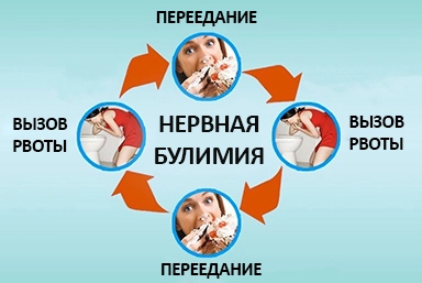 Лечение булимии в Тамбове